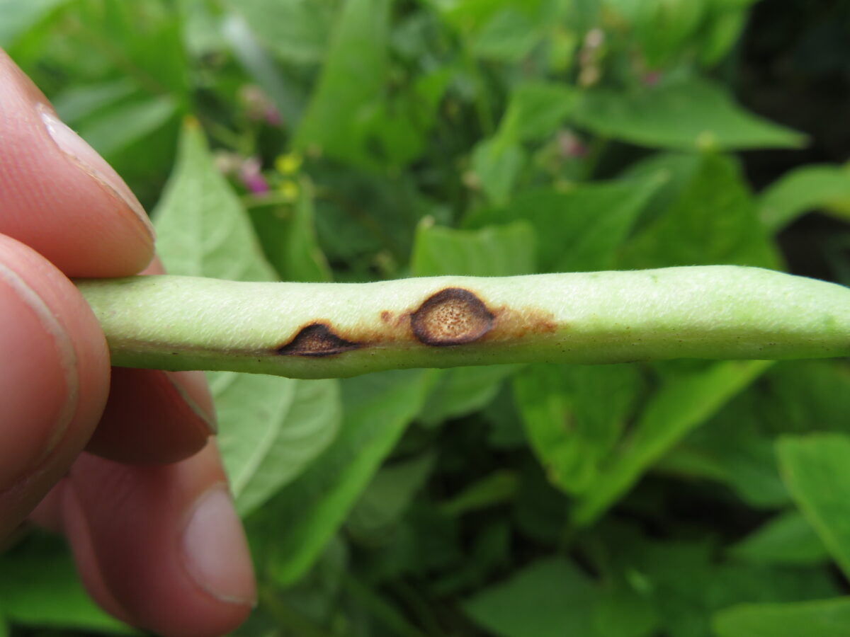 Symptoms of anthracnose on a dry bean pod in which there are two lesions with a dark brown border enclosing multiple tiny orange-brown dots