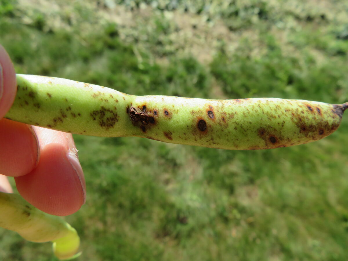 Symptoms of anthracnose on a dry bean pod in which there are a few large dark brown lesions across the pod and light brown speckles scattered across the surface of the pod
