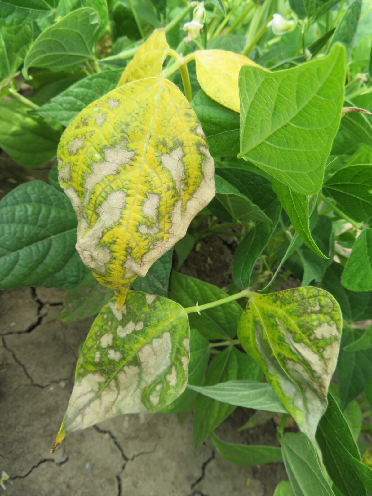 Bacterial wilt symptoms of several dry bean leaves in which there are patches of necrotic areas surrounded by yellow across the surface of the leaves